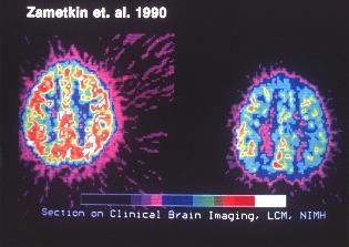Clinical Brain Imaging